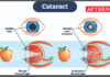 CM Vijay inaugurates advanced eye surgery technology