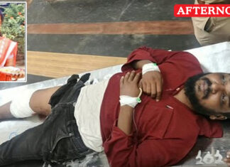 Woman set ablaze at Ponneri government hospital, suspect shot in leg